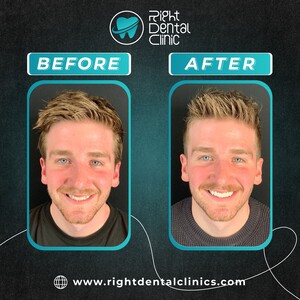 Image of Smile makeover