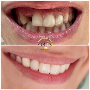 Image of Oris Dental Turkey Gallery 0