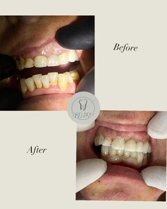 Image of Brahimi Dental Gallery 2