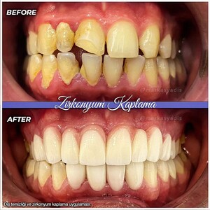 Image of Markasya Dental Clinic Gallery 2