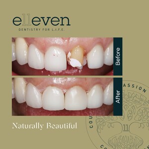 Image of Elleven Dental Gallery 2