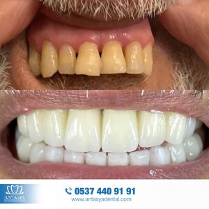 Image of Antasya Dental Gallery 2