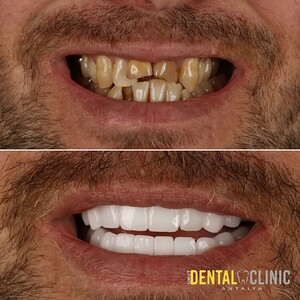 Image of Umut Dental Clinic Antalya Gallery 3