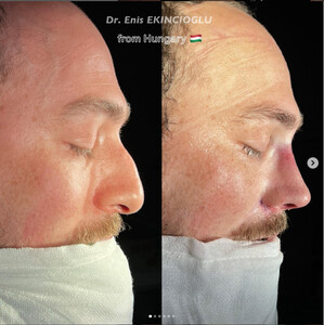 Image of Dr. Enis Ekincioğlu Istanbul Rhinoplasty Clinic Gallery 1