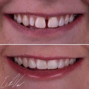 Image of Velez Family & Cosmetic Dentistry Gallery 3