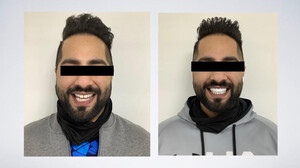 Image of Smile makeover