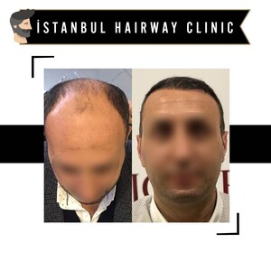 Image of İstanbul Hairway Clinic Gallery 0