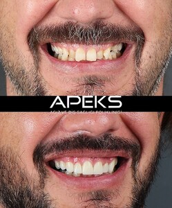 Image of Apeks Dental Clinic - Antalya Gallery 0