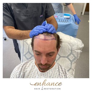 Image of Enhance Hair Restoration Gallery 3