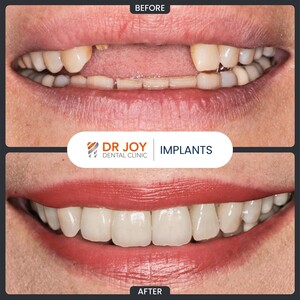 Image of Dr. Joy Dental Clinic Gallery 3