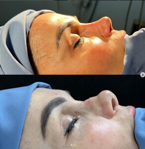 Image of Dr. Sedat Avşar -  HLC Plastic Surgery Center Gallery 0