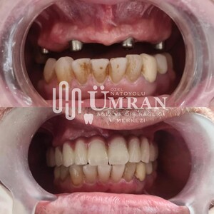 Image of Ümran Dental Center Gallery 3