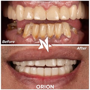 Image of Orion Dental Health Gallery 1