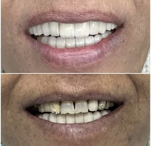 Image of Dental Care Before and After