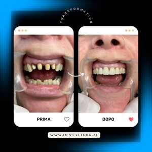 Image of Dental Turk Albania Gallery 2