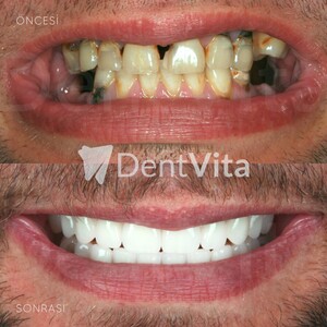 Image of DentVita Dental Clinic Gallery 2