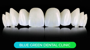 Image of Blue Green Dental Clinic Gallery 2