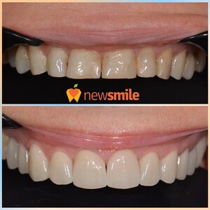 Image of New Smile Dental Clinic Gallery 0