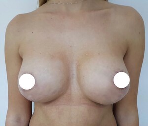 Image of Aesthetic breast surgery