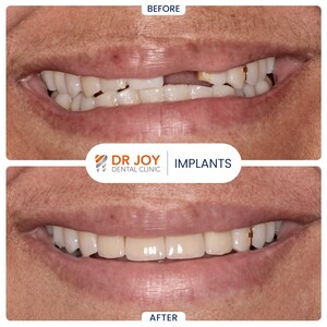 Image of Dr. Joy Dental Clinic Gallery 0