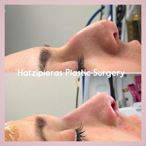 Image of Hatzipieras Plastic Surgery Gallery 1