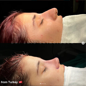 Image of Dr. Enis Ekincioğlu Istanbul Rhinoplasty Clinic Gallery 0