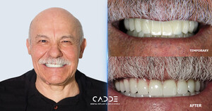 Image of Cadde Dental Gallery 0