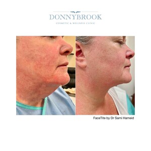 Image of Donnybrook Cosmetic Clinic Gallery 0