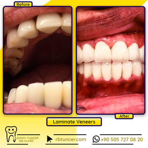 Image of Mustafa Tuncer Dental Clinic Gallery 0