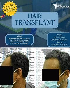 Image of Dr Ruz Hair Transplant Gallery 0