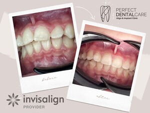 Image of Perfect Dental Care Gallery 3