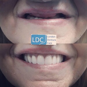 Image of London Denture Care Gallery 1