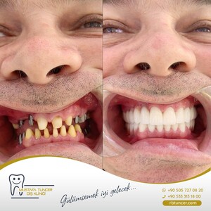 Image of Mustafa Tuncer Dental Clinic Gallery 1