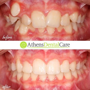 Image of Athens Dental Care Gallery 3