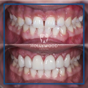 Image of Hollywood Dental Izmir Gallery 2