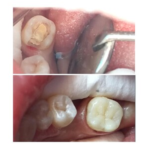 Image of Dental treatment - Italdent