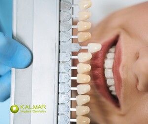 Image of Teeth whitening - Kalmar Implant Dentistry