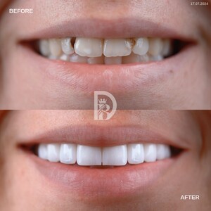 Image of Smile makeover