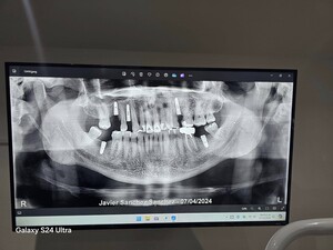 Image of Dental X-Ray