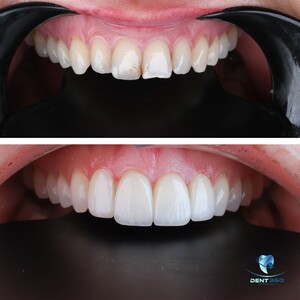 Image of Dental treatment results