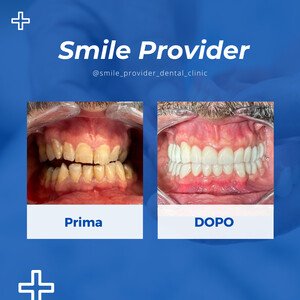 Image of Veneers - Smile Provider