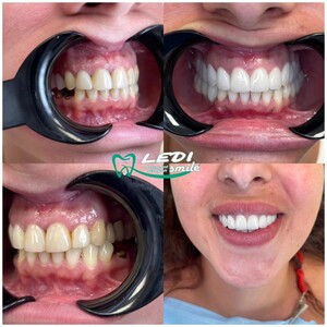 Image of Ledismile Dental Clinic Gallery 0