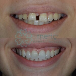 Image of Meriç Dental Clinic Gallery 0