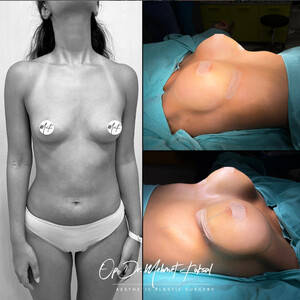 Image of Op.Dr. Mehmet Köksal Aesthetic Surgery Clinic Gallery 2