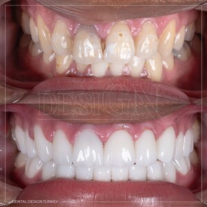 Image of Dental Design Turkey Gallery 0