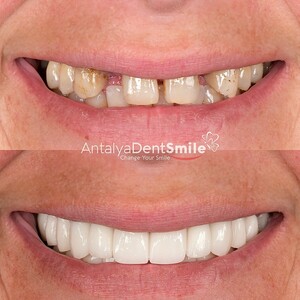 Image of Antalya Dent Smile Gallery 2