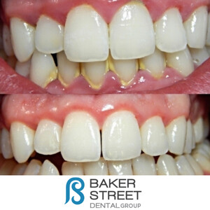 Image of Baker Street Dental Gallery 2