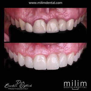 Image of Milim Dental Gallery 1