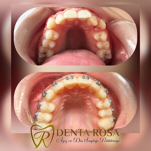 Image of Denta Rosa Oral and Dental Health Polyclinic Gallery 0