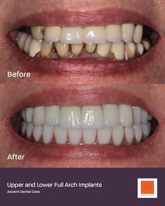 Image of Ascent Dental Care Gallery 2